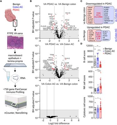 B cell immune profiles in dysbiotic vermiform appendixes of pancreatic cancer patients